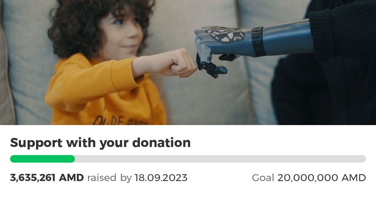 Prosthetic Arms for Amputees